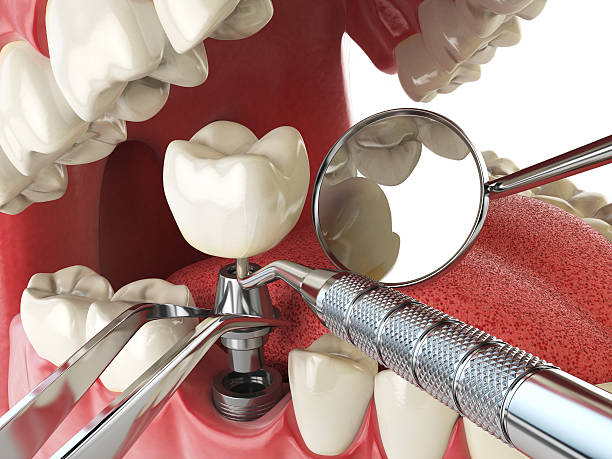 Best Walk-In Emergency Dentist in Nekoosa, WI